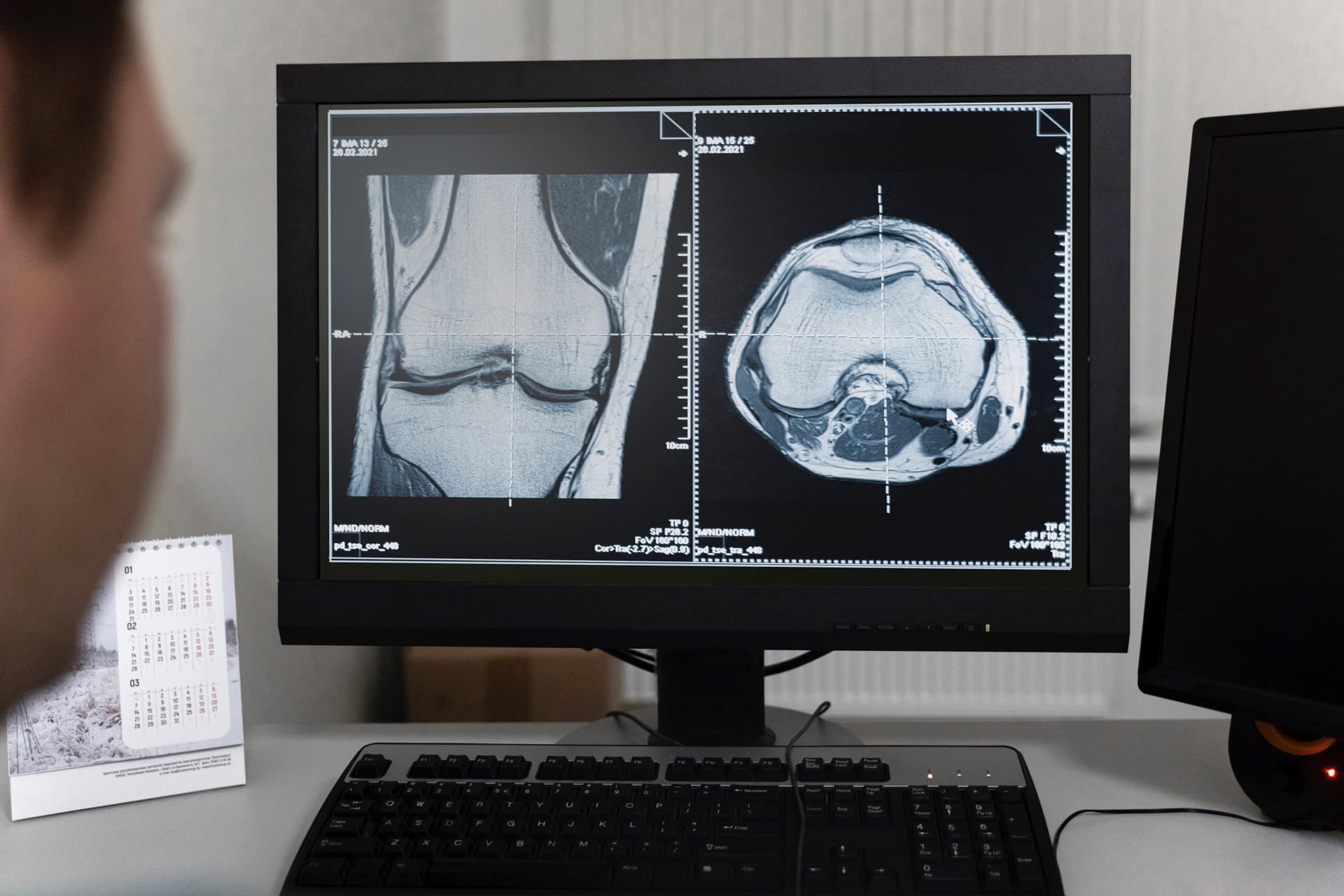 onMRI — AI-powered Objective MRI Analysis for Quantifiable Musculoskeletal Imaging